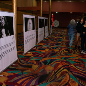 “Los Rostros de la Leucemia Mieloide Crónica”: la muestra fotográfica que rescata la realidad de los pacientes llega a Arica