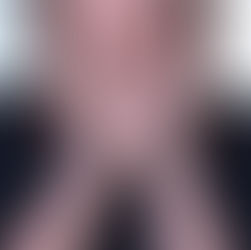 ¿Ronquera, una llaga que no sana o un bulto en el cuello? Las señales que podrían alertar sobre un cáncer de cabeza y cuello