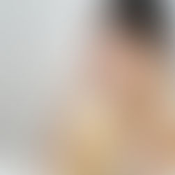 Especialista en oncología ocular advierte alza de cánceres oculares y refuerza llamado a proteger los ojos