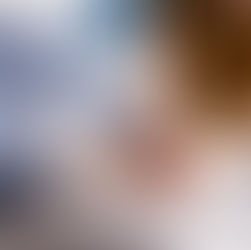 Leucemia Mieloide Aguda ¿A quiénes suele afectar este tipo de cáncer?