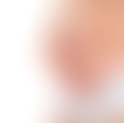 Endometriosis: Causa síntomas invalidantes en el 82% de las pacientes