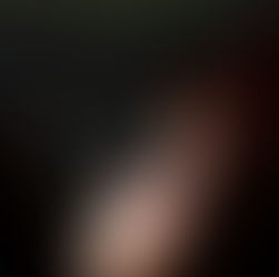 El consumo excesivo de azúcar y diversos tipos de bebidas puede aumentar el riesgo de bruxismo