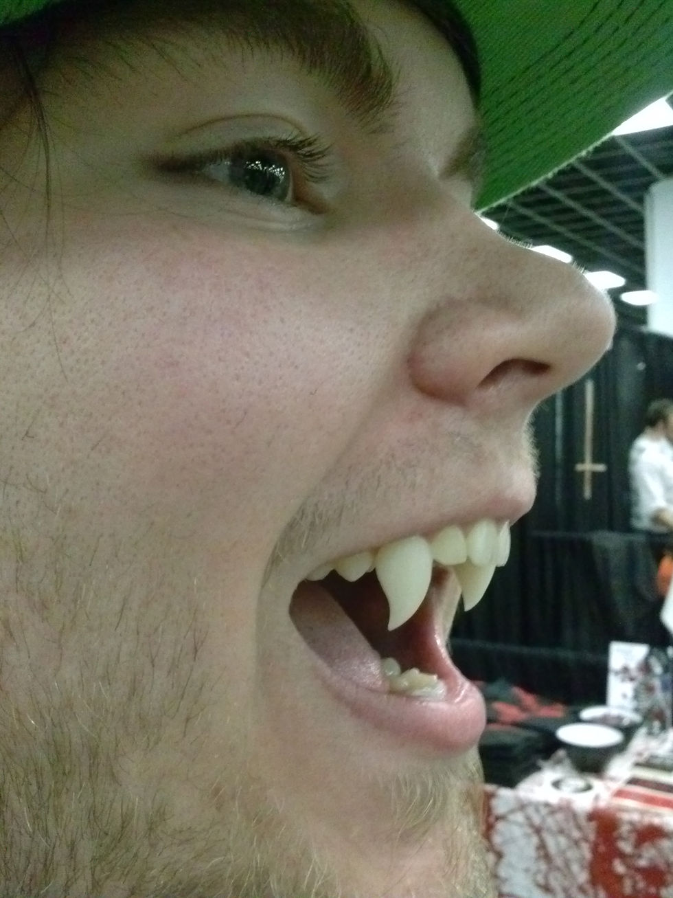 Thumbnail: Single Snakes Bites