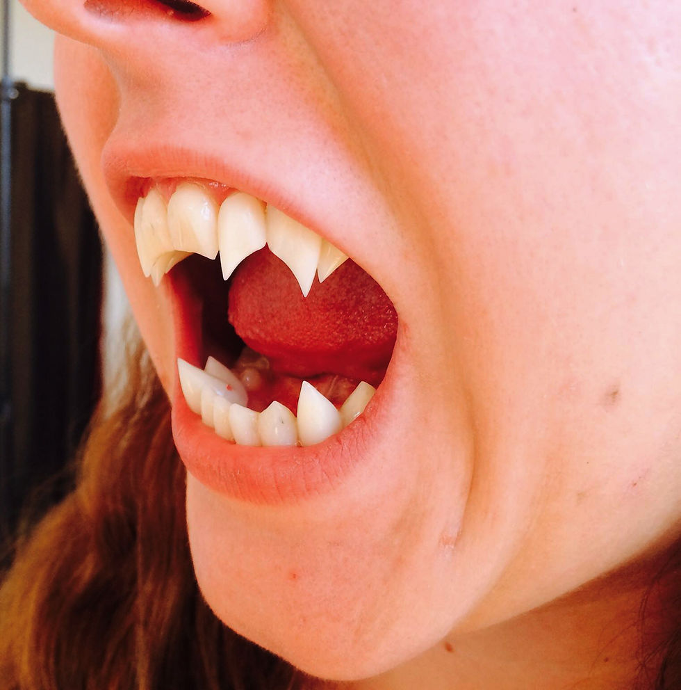 Thumbnail: Teen Wolf - SCOTT'S ALPHA FANGS