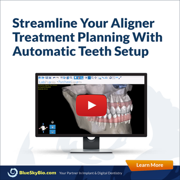 Streamline Your Aligner Treatment Planning With Automatic Teeth Setup