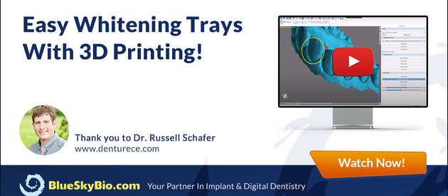 Easy Whitening Trays With 3D Printing
