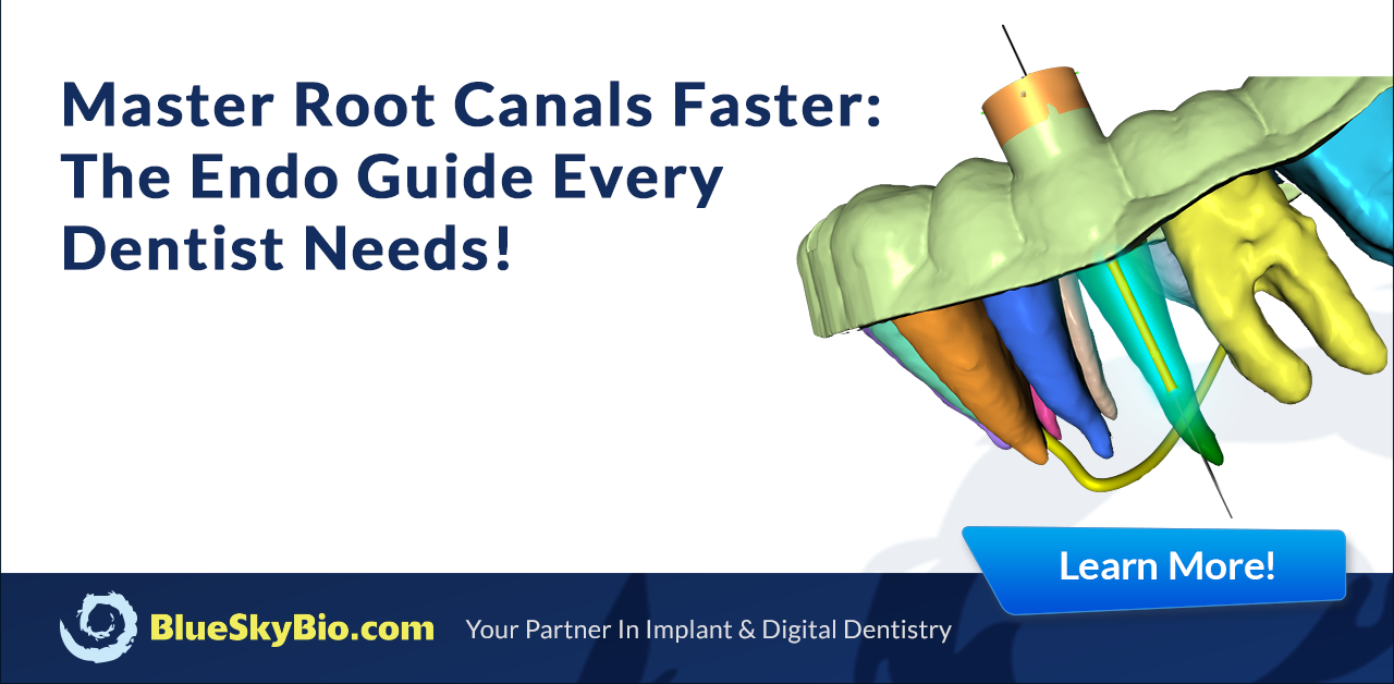 Endo Roots Master Root Canals Faster: The Endo Guide Every Dentist Needs! | Blue ...