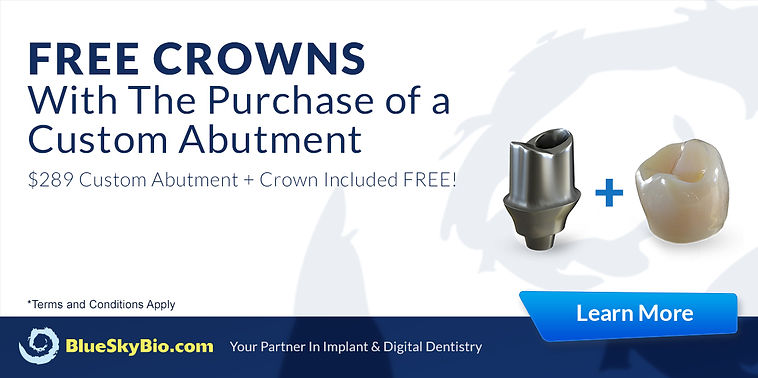 free-crowns-LP-banner-abutment-1200x600.jpg