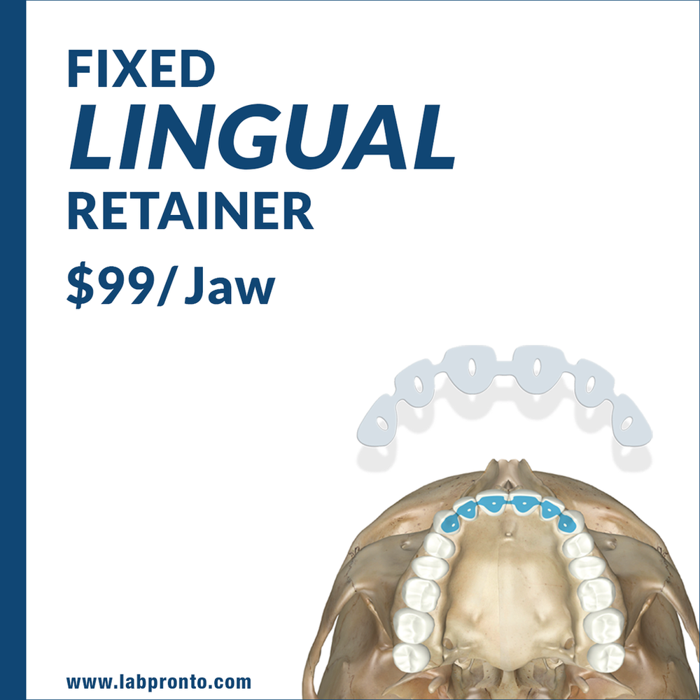 NEW Service Fixed Lingual Retainer Now Available on