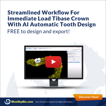Streamlined Workflow For Immediate Load TiBase Crown With AI Automatic Tooth Design