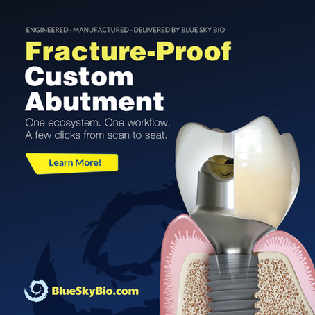 NEW Premium Fracture Proof Custom Abutments! (Free Crown Included!)