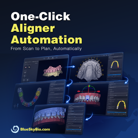 How to Plan a Complete Clear Aligner Case in 5 Minutes!