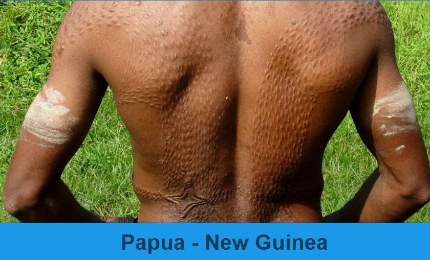Papua - New Guinea