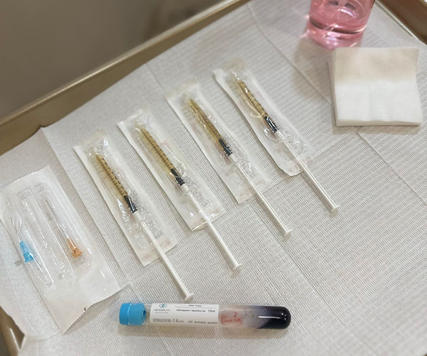 PRF Injections