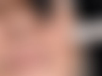 código de barras en los labios: cómo lograr una mejoría notable con plasma iq en cali
