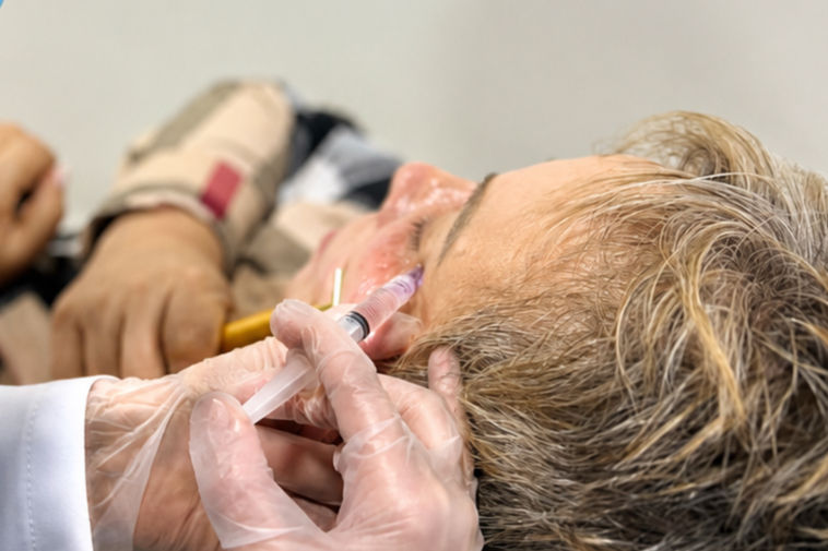 relleno de ojeras ácido hialurónico contorno ojos - Dra. Juliana Castellanos Cali