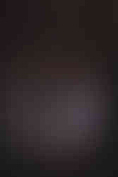 Outdoor drinks reception during a Scotland woodland wedding photographed by a Scotland wedding photographer.