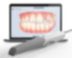 Intraoral Dental 3D Scanner