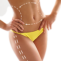 Acoustic Wave body contouring