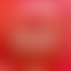 Prefeitura monta força-tarefa para atuar em emergências causadas pela chuva em Subaúma