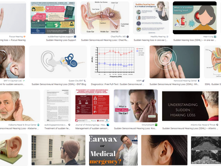 אובדן שמיעה פתאומי (SSHL): מה לדעת Sudden Hearing Loss (SSHL): What To Know