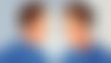 Homem com a mão na cabeça olhando para a queda de cabelo em um espelho