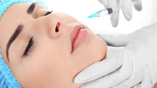 Prevenção do envelhecimento: Preenchimento, Ultrassom Microfocado e Fios de Sustentação