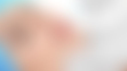 Prevenção do envelhecimento: Preenchimento, Ultrassom Microfocado e Fios de Sustentação