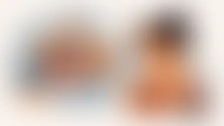 Alimentos a evitar durante a acne