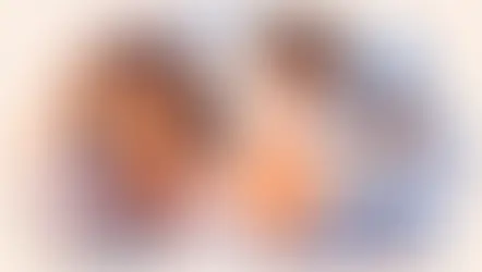 Guia completo sobre alopecia feminina hoje