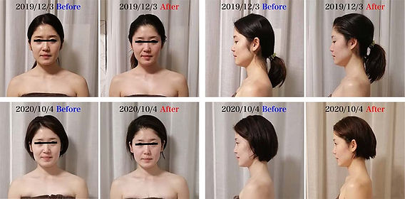 骨格から整える小顔矯正 骨格から若返る/小顔矯正・骨盤矯正・シミケアの専門院 OSAKA/UMEDA