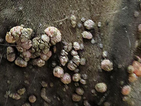 What is that lump?
