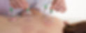 Cupping.jpeg
