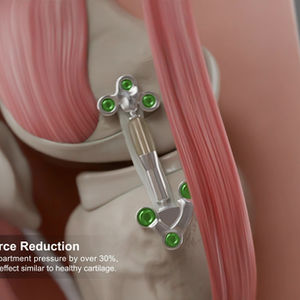 무릎 하중감소장치 3D 애니메이션