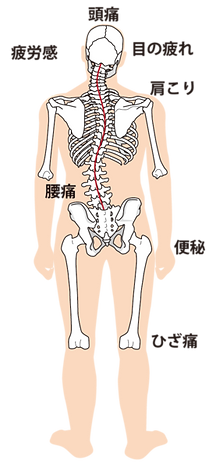 全身の歪み