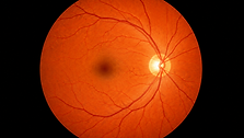 Retina.png