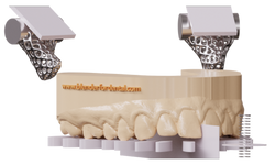 Dental jaw and articulation