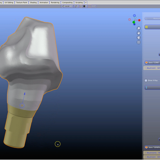 B4D Implant Abutment