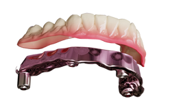 New teeth on dental implants