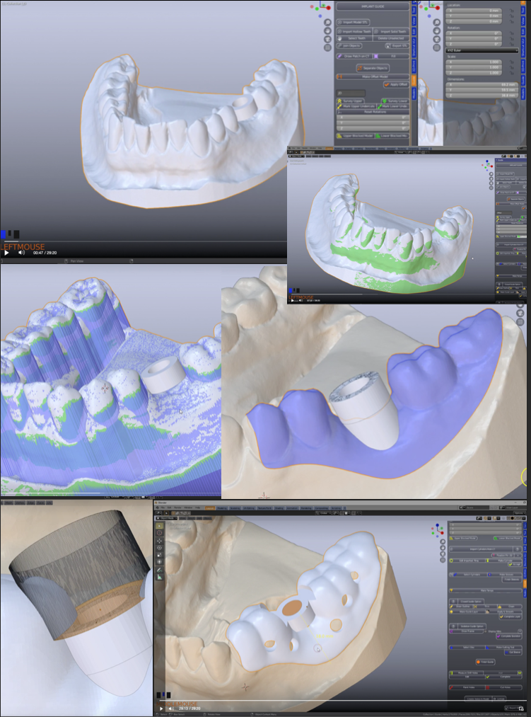 open dental tutorials open dental tutorials