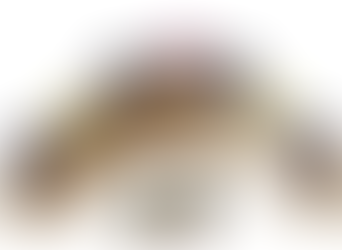 Revolutionising Custom Abutments and Implant Bars