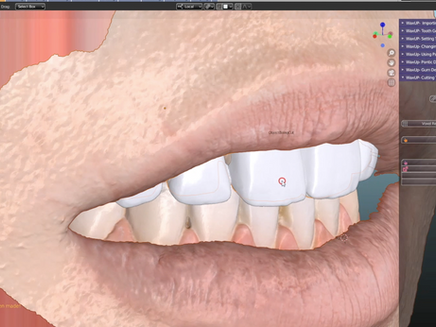 The Waxup module is here! ...and is guaranteed to impress.