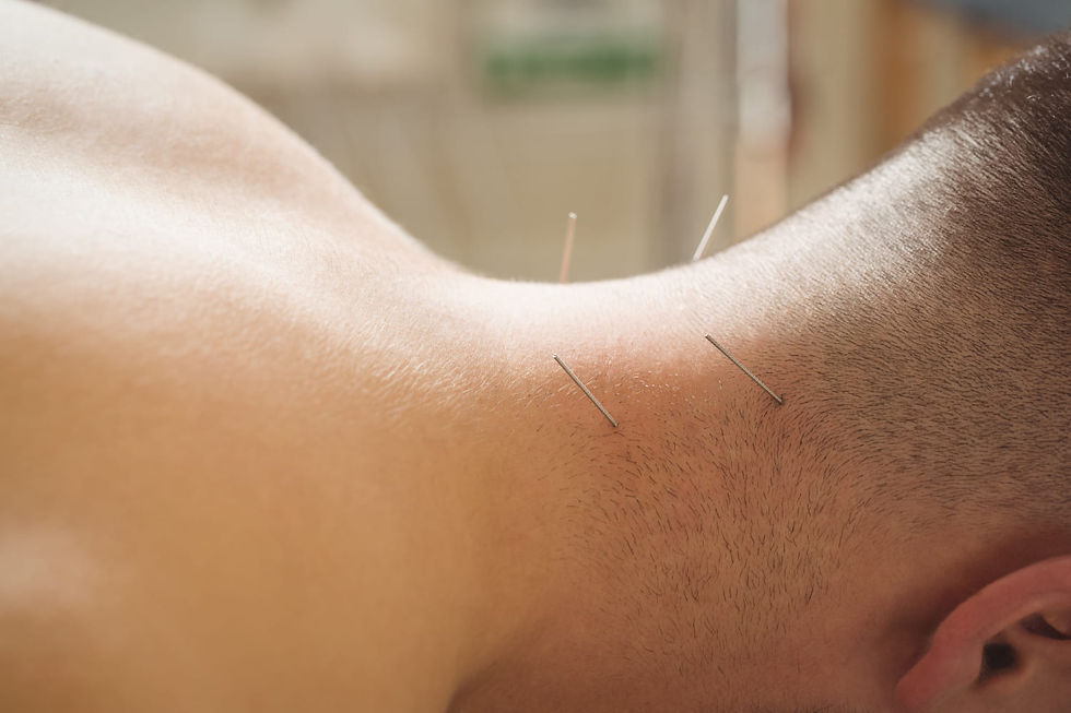 Chinese Medicine Acupuncture