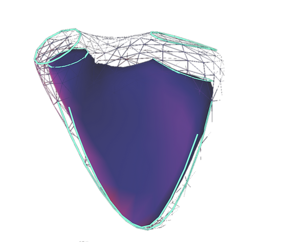 CombinedView%252520(1)%252520(1)_edited_