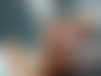 Top Benefits of Radiofrequency Skin Therapy: Unlock Your Skin’s Natural Glow