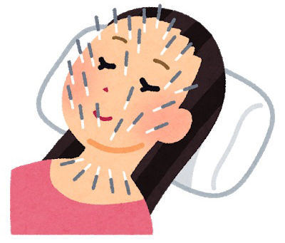 コラーゲン誘発鍼は最先端の美容鍼の手法!