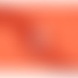 Супорт Кочани со втора пратка компресивна облека за повредените во пожарот