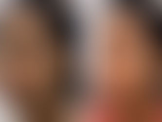 Preenchimento de Olheira: o que saber antes de fazer