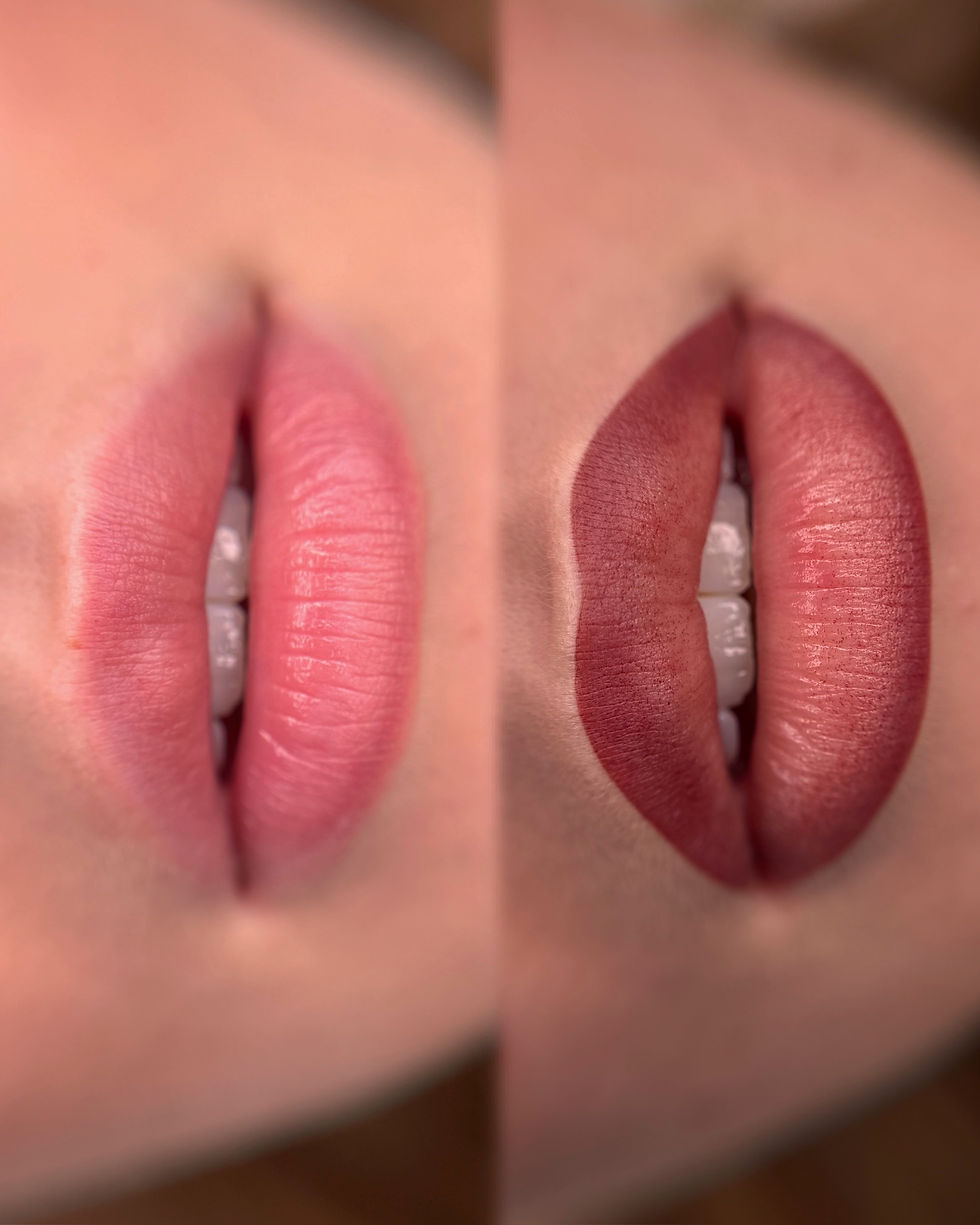 Before en after