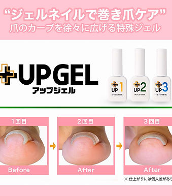 UP-GEL POP 1.jpg